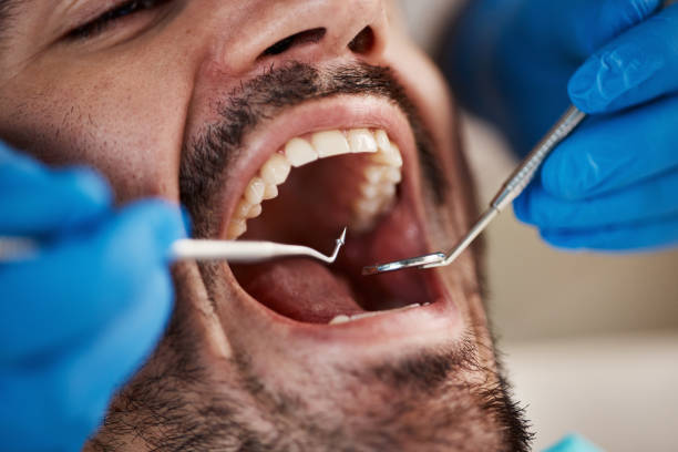 Best Root Canal Treatment  in Anniston, AL
